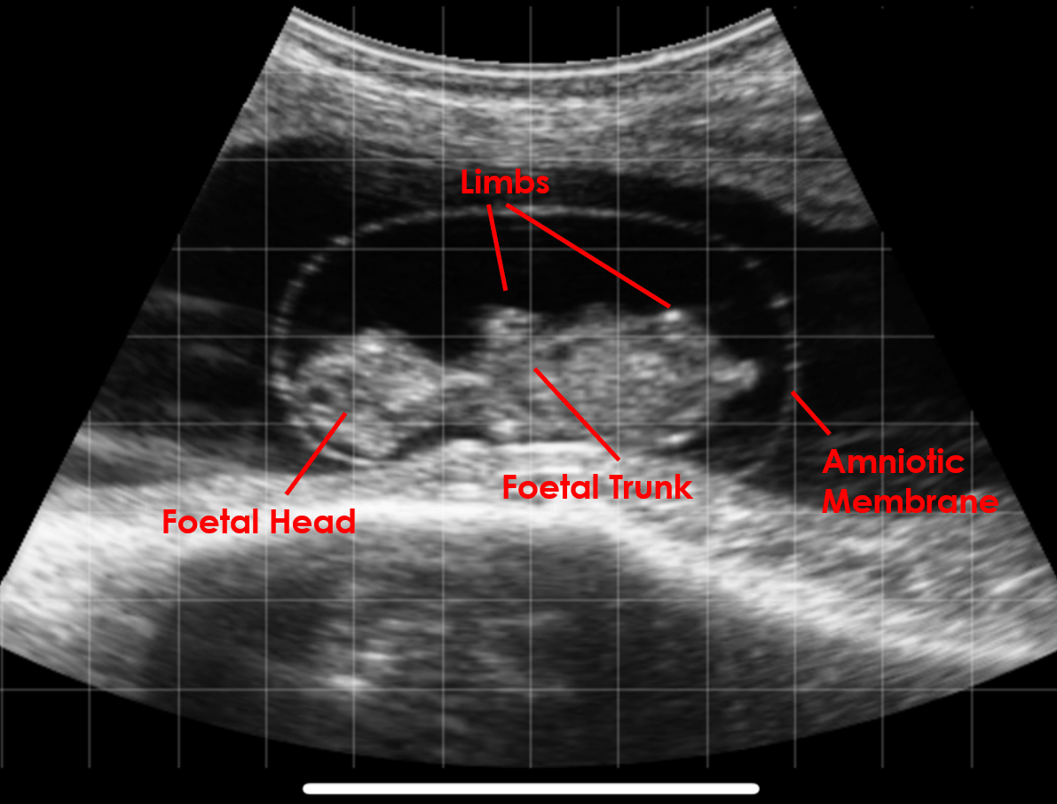 54 day pregnancy bovine EasiScanGo curve IMV imaging