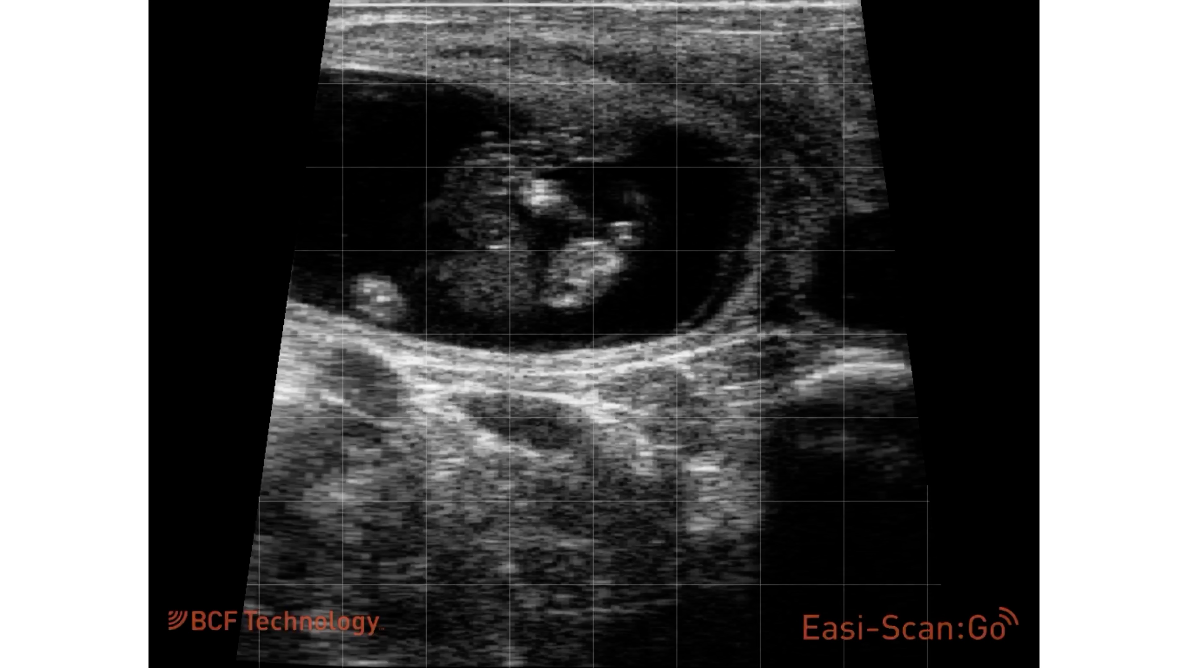 65 day female calf fetus