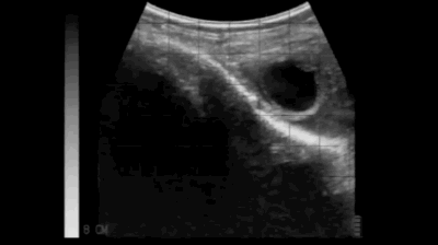 Fetus normal bovine 62 days BCF Easi-Scan