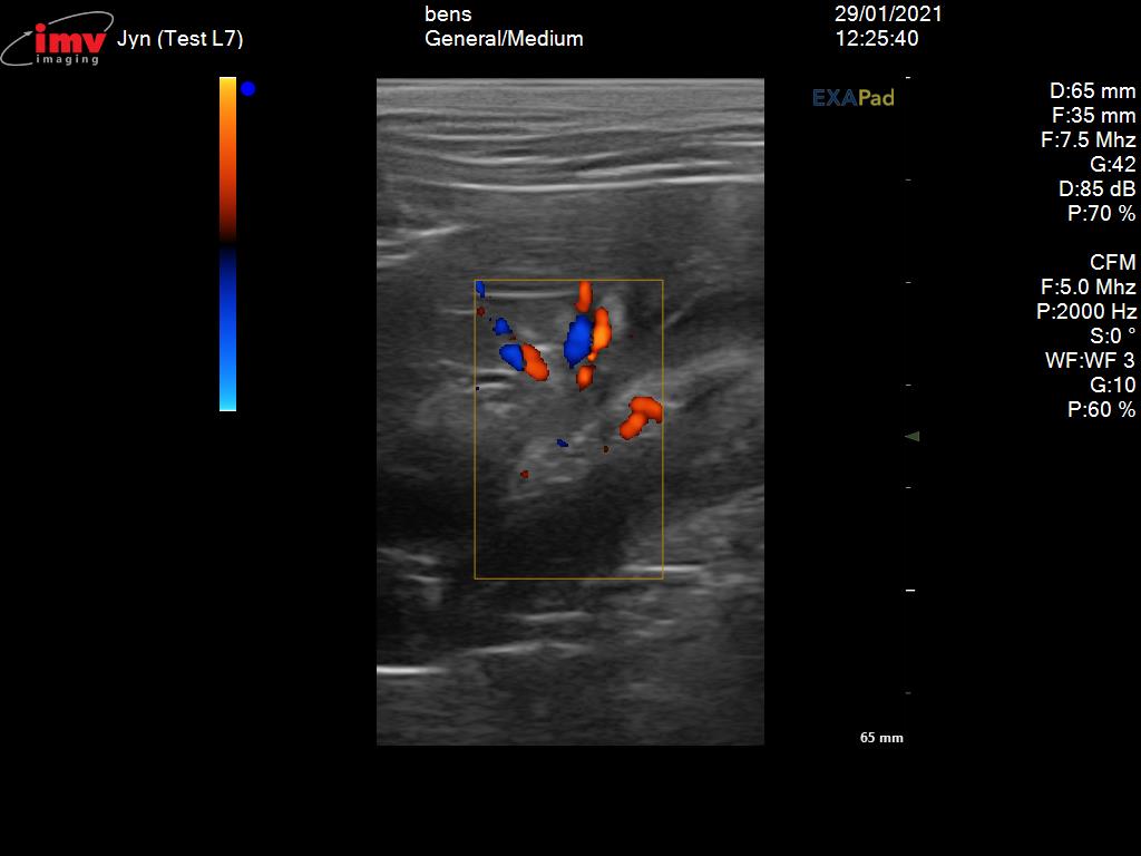 Small Animal Exapad Ultrasound Kidney Doppler 