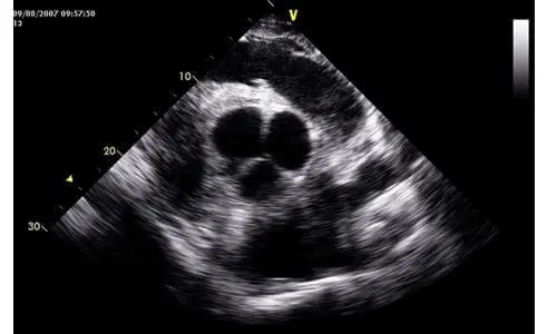 Aortic valve normal equine GE LOGIC e 3S-RS