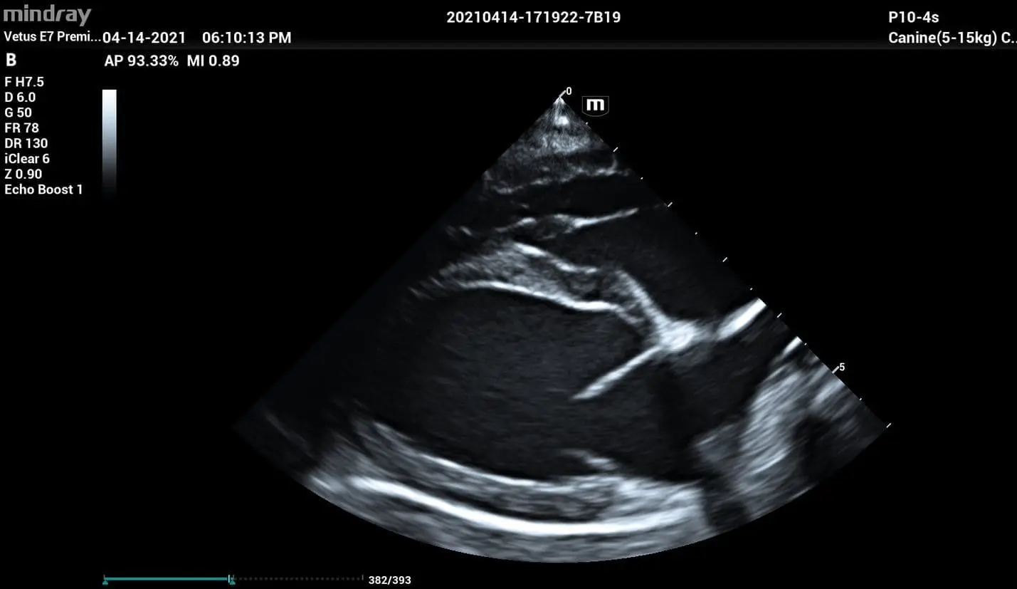 Z ultra sound clearance boost