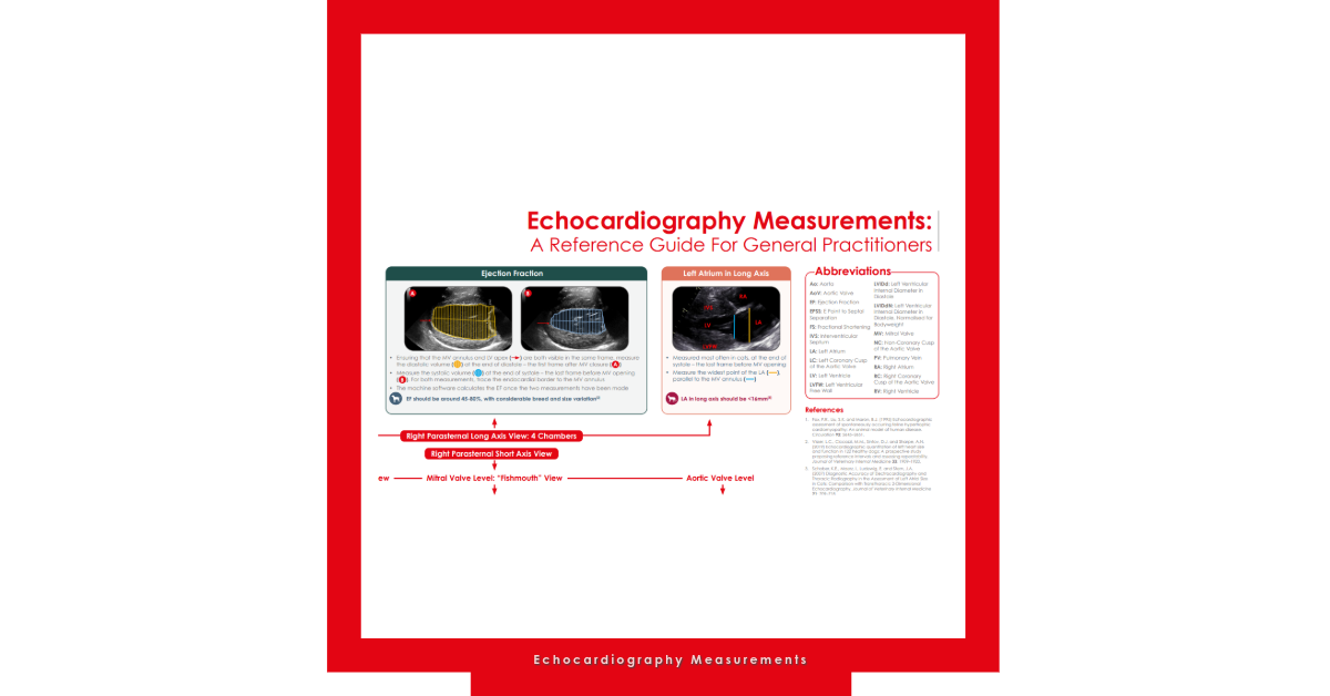 Free Download: Echo Measurements Poster