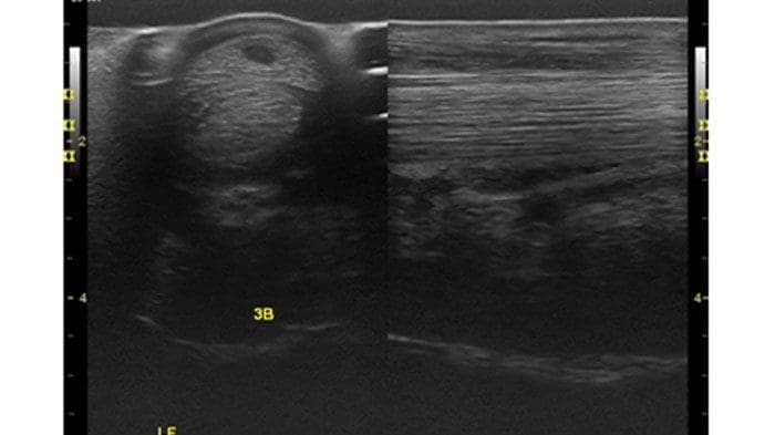 Distal limb comparison SDFT core lesion equine GE LOGIQ e 12L