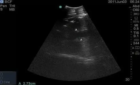 Fetus normal equine late gestation transabdominal aorta measurement Sonosite M-Turbo C60