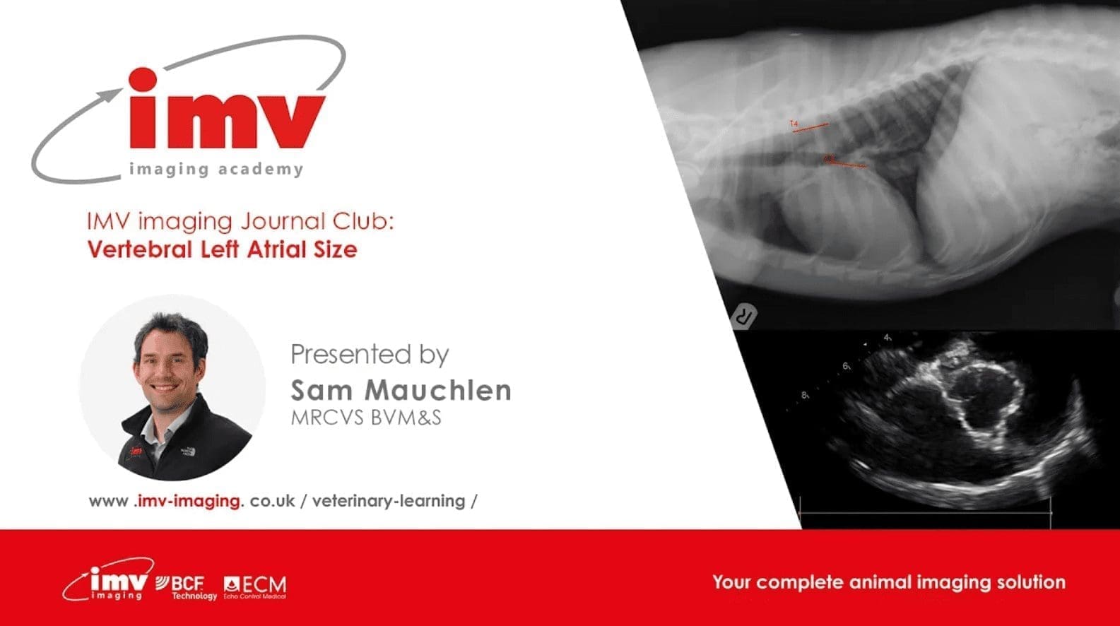 Journal Club - Vertebral Left Atrial Score (VLAS)