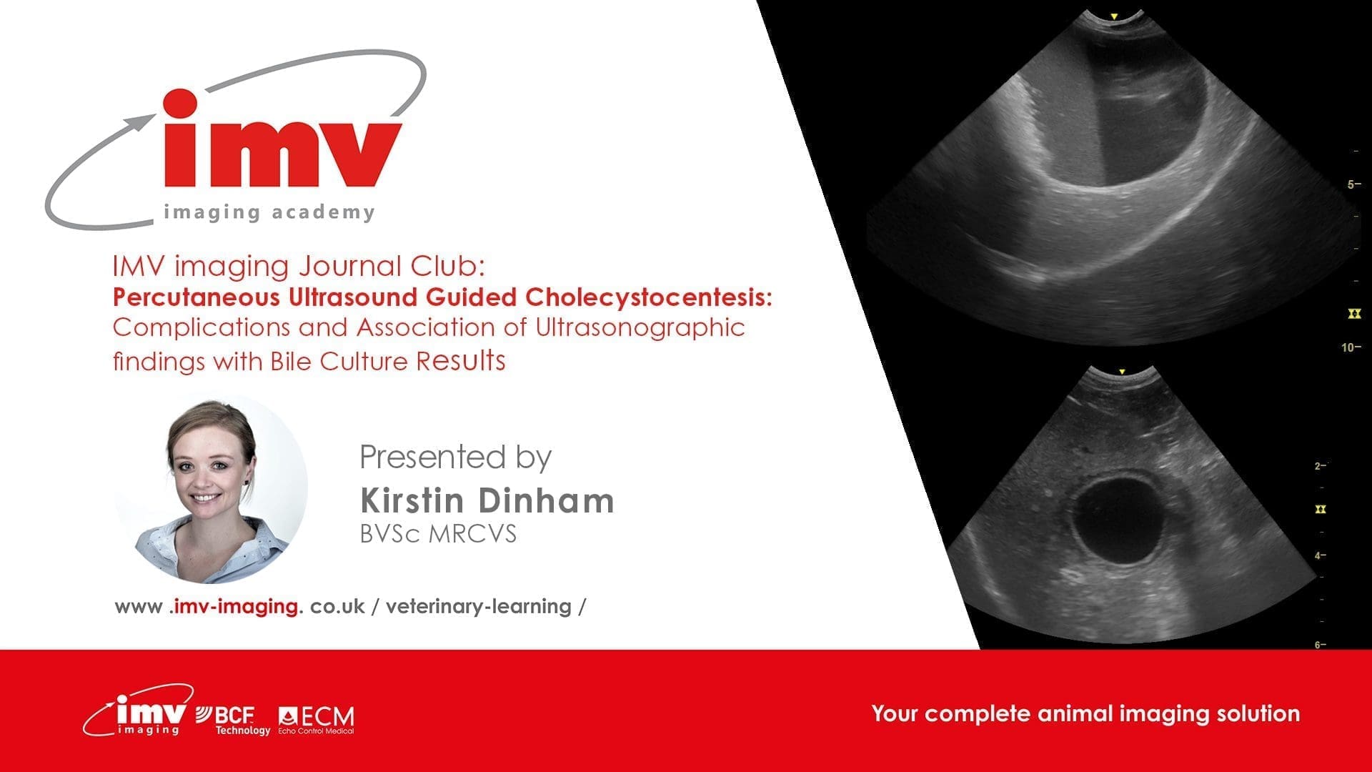 Journal Club - Percutaneous Ultrasound Guided Cholecystocentesis